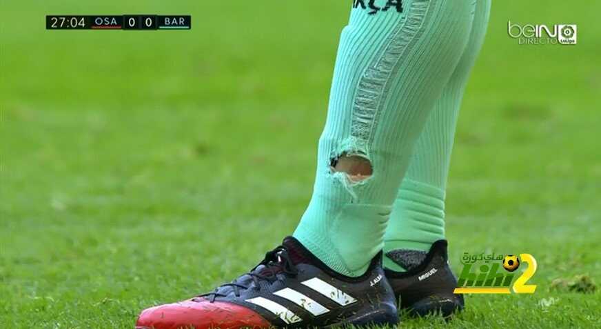 صورة : جورب ألبا يتمزق أمام أوساسونا
