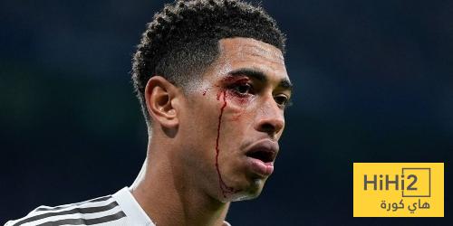 ثلاثي ريال مدريد يعانون من انزعاجات