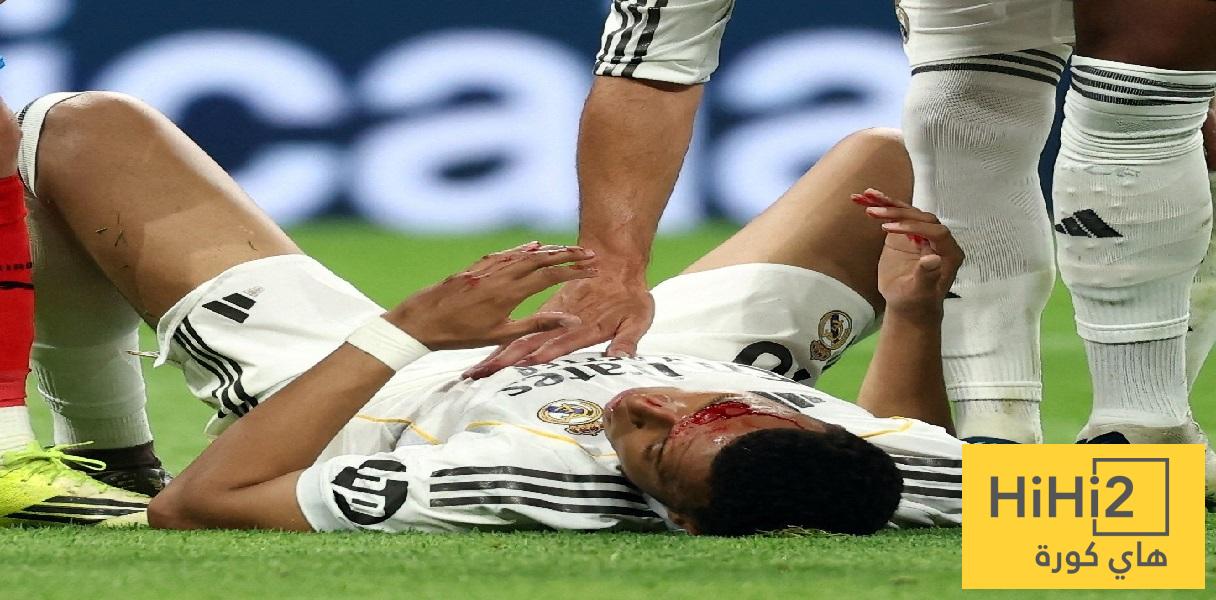 دماء مبابي تدفع لجنة الحكام للتدخل في أزمة مباراة الريال وغيرونا